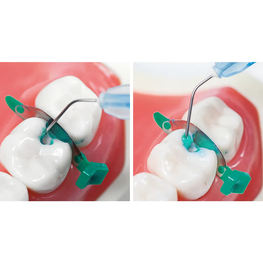 Microgel SF - Image 3